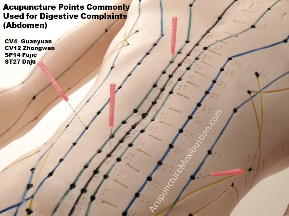 Acupuncture