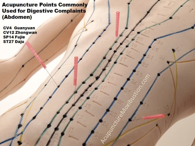 WHAT CAN BE TREATED WITH ACUPUNCTURE?